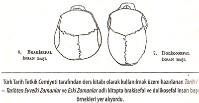 brakisefal-dolikosefal-insan-kafatasi